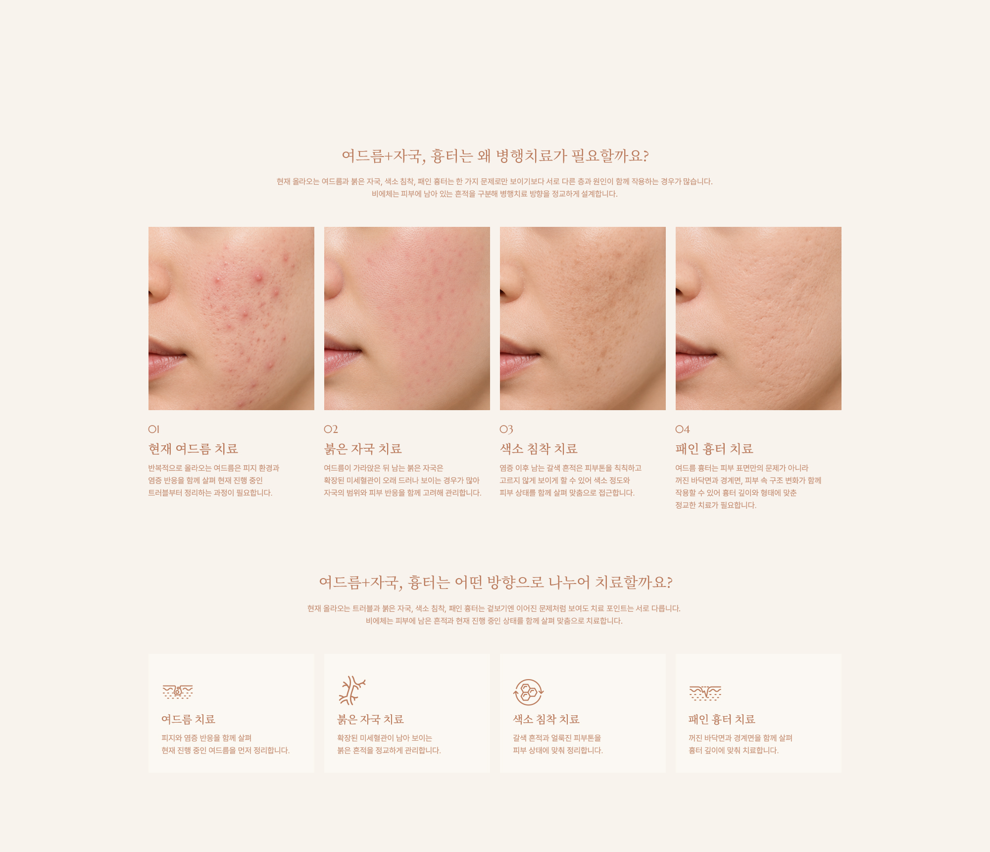 여드름+자국, 흉터