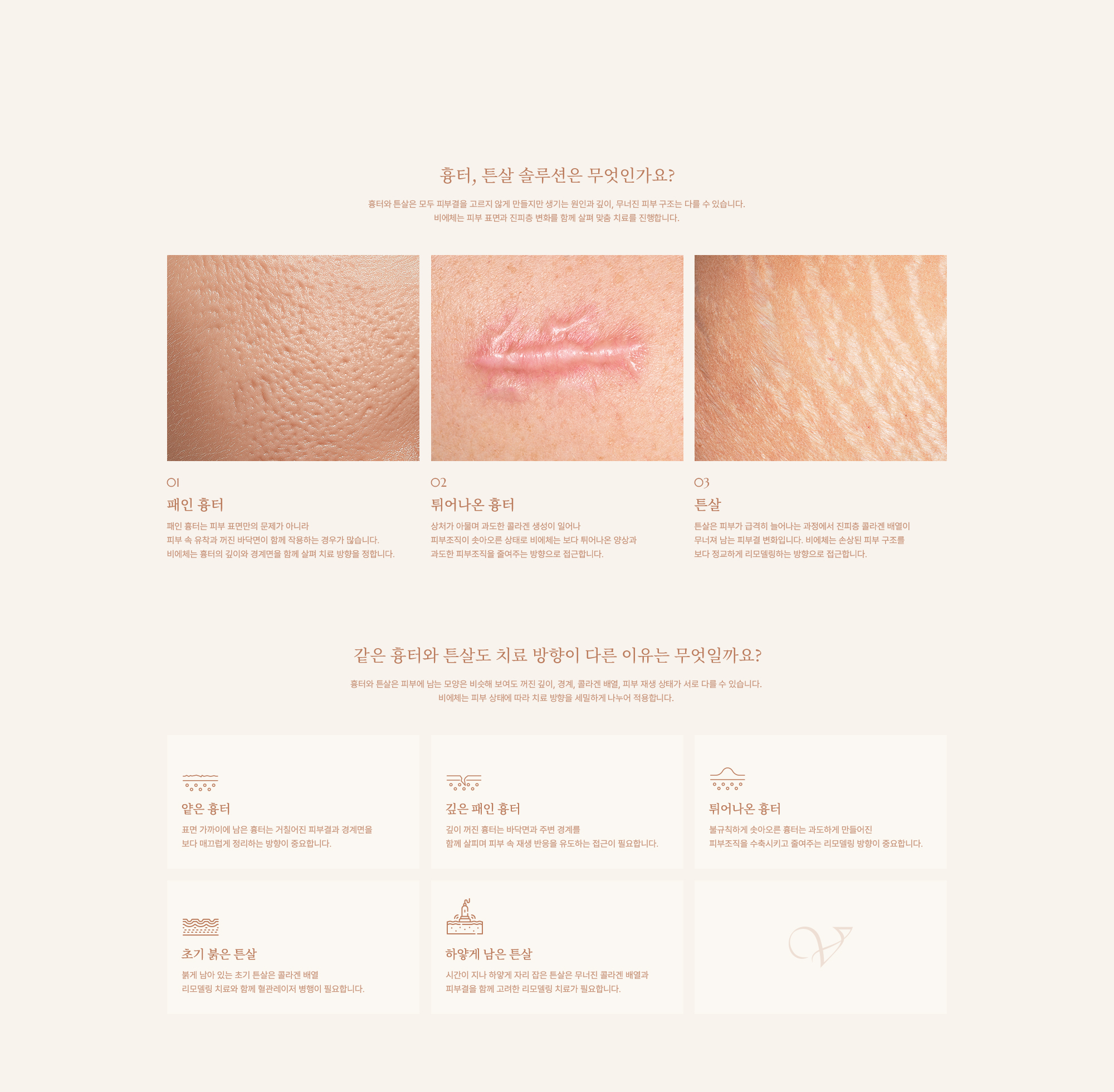 흉터, 튼살 솔루션