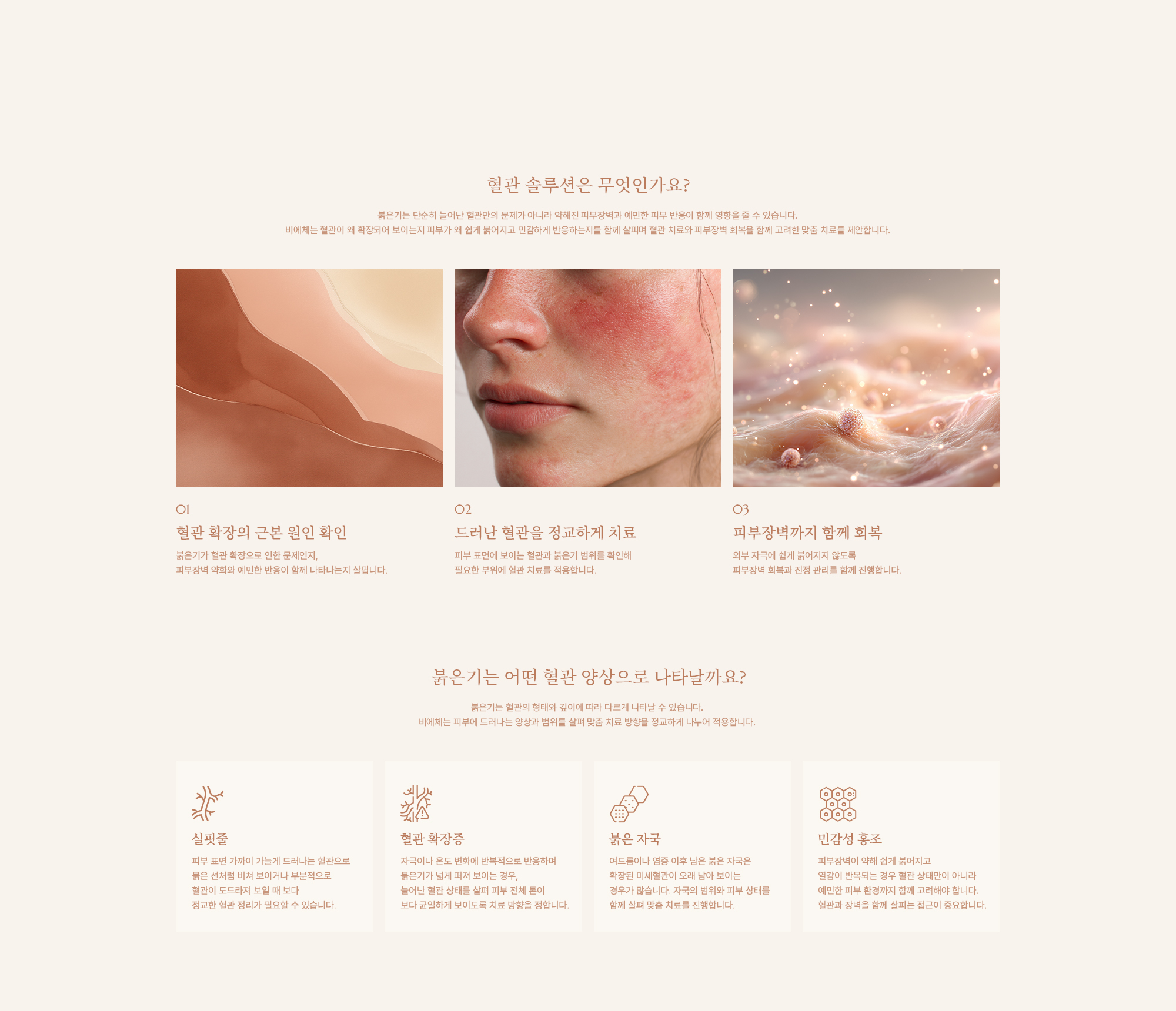 혈관 솔루션